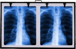 Fidelis Healthcare Xray view Box Digital for Clinic LED Premium Double ...