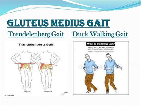 Image result for Contralateral Gait