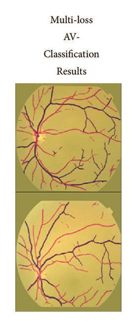 Image result for Channel AV Classification