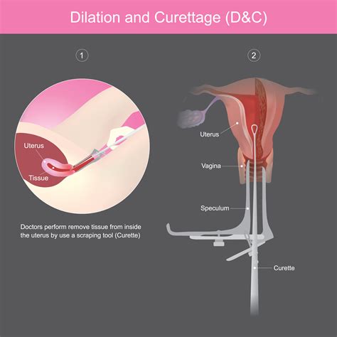 Curetted Artery Imaging The Development Of The Human Craniofacial