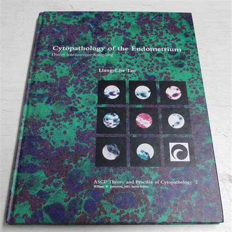 Buy Cytopathology of the Endometrium: Direct Intrauterine Sampling ...