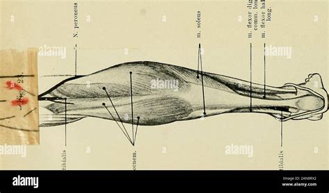 Image result for Extensor Digitorum Communis