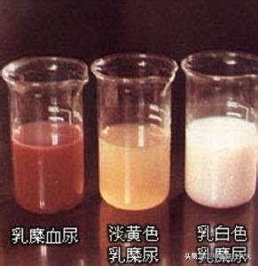 你的尿液什麼顏色？醫生說：可以看尿液顏色來檢查身體 - 每日頭條