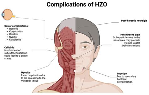 Pathogens | Special Issue : Herpesvirus Diseases in Humans and Animals