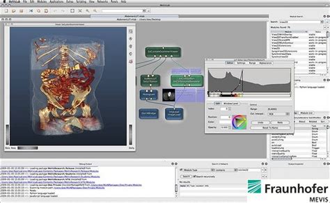 Image result for MeVisLab Features