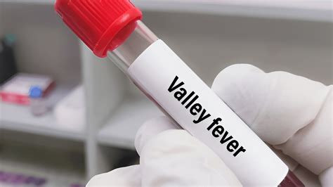 Valley Fever Outbreak: California Sees Alarming Surge In Cases, Know ...