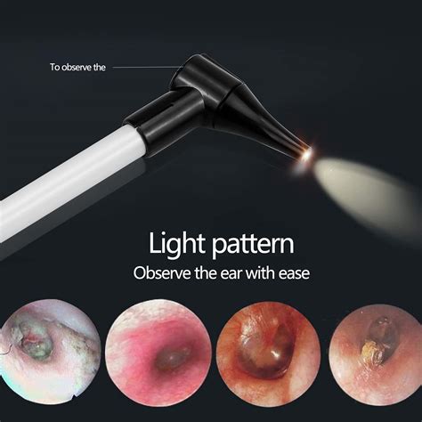 Ear Light Otoscope, Portable HD Ear Microscope, Diagnostic Penlight ...