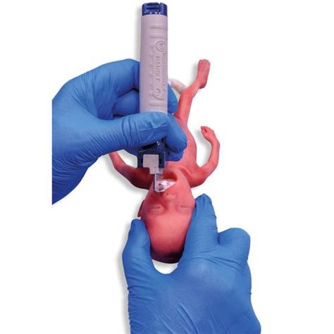 Micro-preemie Baby / Extremely Low Birth Weight Baby (ELBW) - 1024668 ...