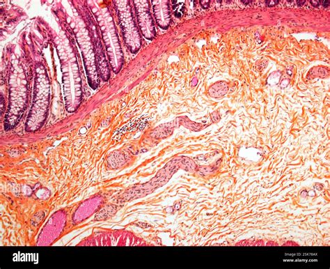 Micrographie lumineuse d'une section de la paroi élargie du gros ...