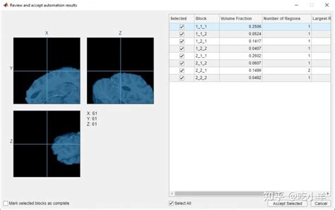 Image result for Volume Segmenter MATLAB Tutorial
