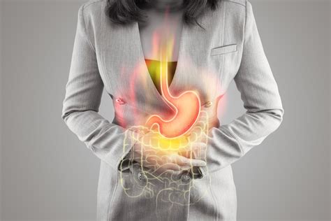 Acid Reflux: Causes and Treatment Options — Gastro Florida