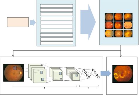 Image result for Channel AV Classification