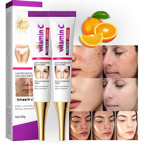 Niacinamide Melasma Cream, Crema para Manchas India | Ubuy