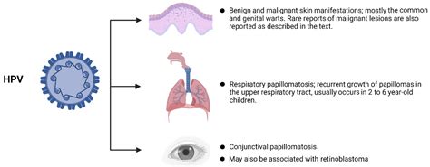 Human Papillomavirus Infection during Pregnancy and Childhood: A ...