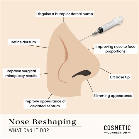 Non Surgical Rhinoplasty | Facial aesthetics, Nose reshaping, Aesthetic medicine