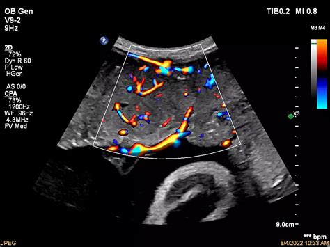 Philips Affiniti 50 ultrasound machine