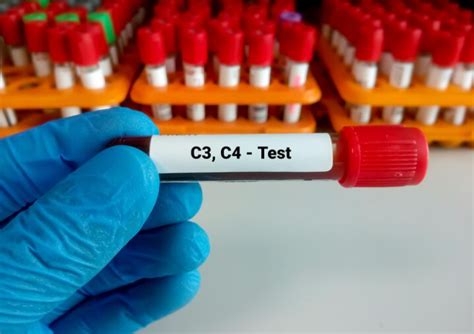 Image result for C4 Complement Blood Test