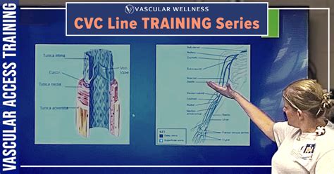 Image result for Purpose of CVC Line