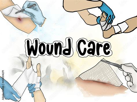 Wound care | Wound care, Wound care nursing, Wound healing nursing