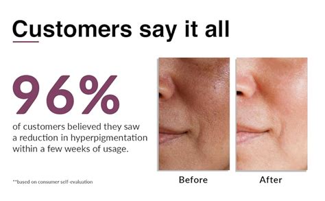 Buy Fixderma Tranexamic Acid Pigment Correcting Serum | Face Serum for ...