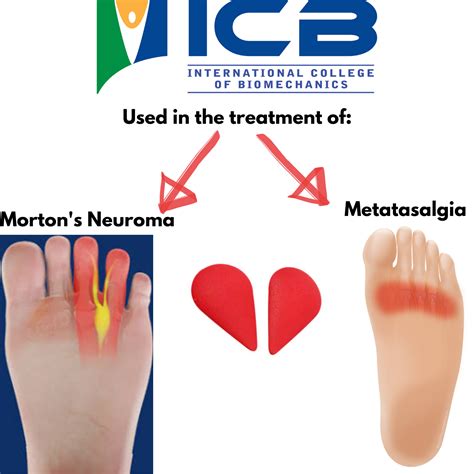 ICB Metatarsal Domes | Pack of 5 Pairs | Morton's Neuroma Treatment | FREE POST | eBay