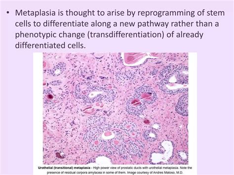 Metaplasia & Dysplasia | PPTX