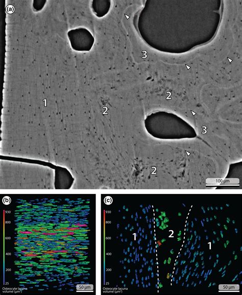 Osteocytes In Lacunae