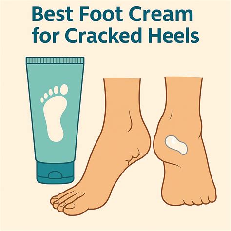 Best Foot Cream for Cracked Heels 2025 - FeetHealth