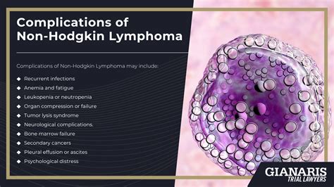 Railroad Non-Hodgkin's Lymphoma Lawsuit [2026 Guide]