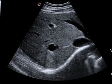 MyLab™Omega handheld portable ultrasound for any application - Esaote