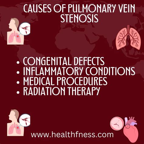 Pulmonary Vein Stenosis: Causes, Symptoms and Treatment 2023 | HealthFness