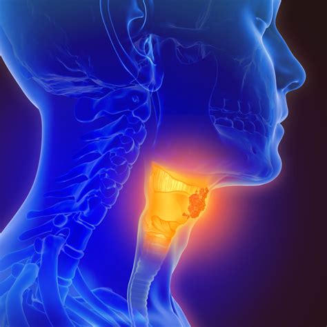 Hpv In Throat