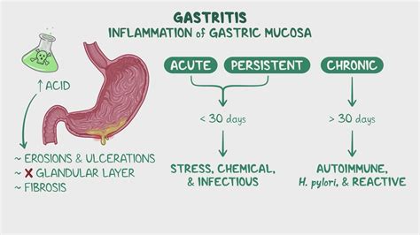 Acute Gastritis Gastritis】Distinguishing Acute Gastritis From