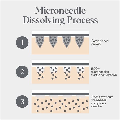Wrinkles Schminkles Self-Dissolving Microneedle Patches - - Planet Beauty
