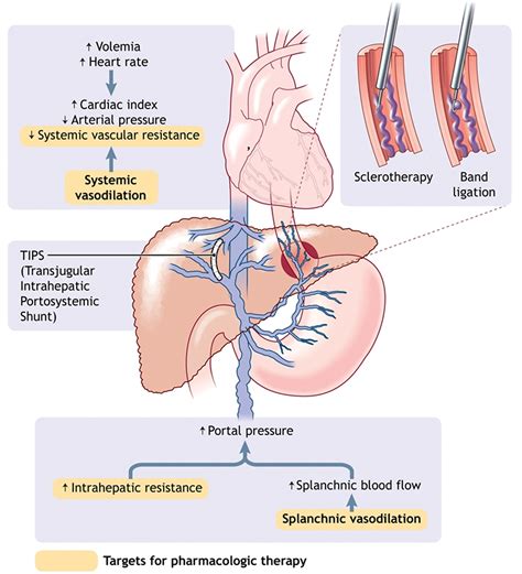 Esophageal Varices - Causes, Symptoms, Grading, Diagnosis, Treatment