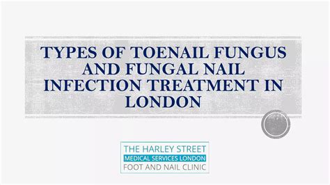 Types Of Toenail Fungus And Fungal Nail Infection Treatment In London | PDF