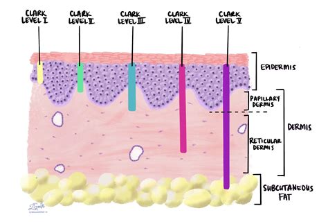 Your pathology report for squamous cell carcinoma of the skin | MyPathologyReport