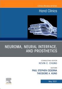 Neuroma, Neural Interface, and Prosthetics, An Issue of Hand Clinics ...