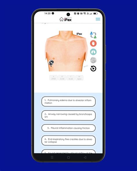 On December 4, the quiz focuses on identifying pleural friction rubs ...