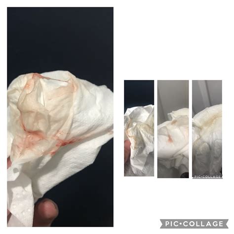 Ovulation/Implantation bleeding ? I need help