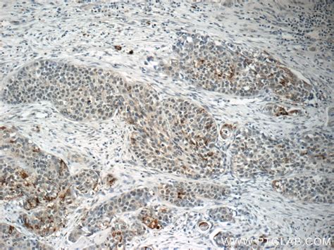 BRD7 antibody (51009-2-AP) | Proteintech
