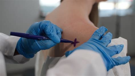 Trigger Point Injections 的图像结果