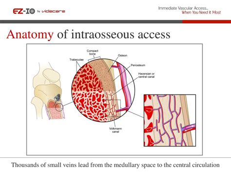 Image result for Intraosseous Access Procedure