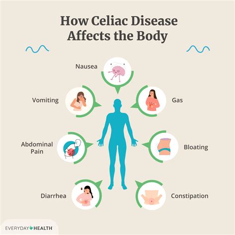 All Celiac Disease Articles