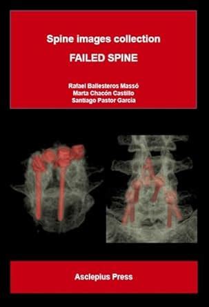 FAILED SPINE: Spine images collection eBook : Ballesteros Massó, Rafael ...