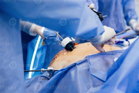 Instruments for gastroscopy and colonoscopy close-up. The doctor holds ...