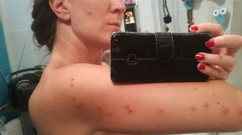 ANTWERP INN HOTEL - Hotel Reviews & Photos - Tripadvisor