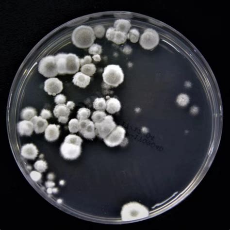 阿根廷首现超级真菌感染病例！美国疾控中心：可以人传人-新闻频道-和讯网