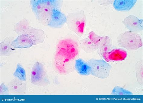 Squamous Epithelial Cells Under Microscope View for Education Hi Stock ...
