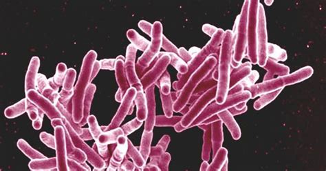 Lab notes: Only optimal levels of a cell division protein allows the ...